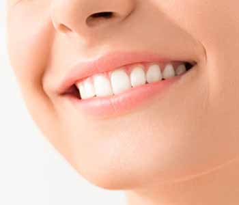 Dr. Sam Gupta of Mount Royal Dental is an experienced dental provider who is pleased to offer cosmetic solutions such as professional teeth whitening for patients who want a more effective solution than over-the-counter offerings