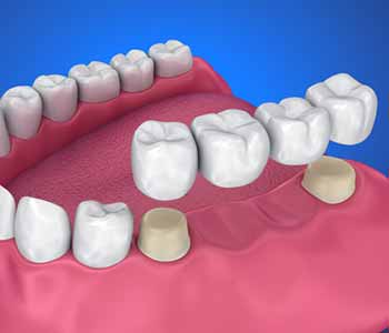 A cosmetic and restorative dentist can provide options for patients to choose from that can completely rejuvenate the appearance of the smile.