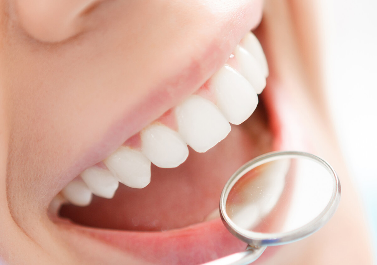 What to Expect from Tooth Crown Services in Burlington Area